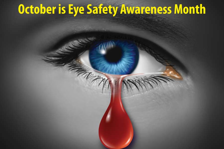 Midwest Vision Centers Eye Injury Prevention Month